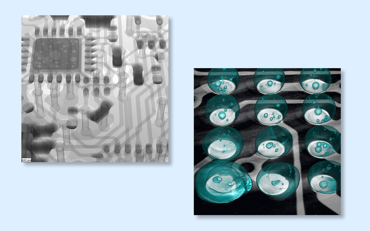 4. 2D vs 3D CT X-ray Which One Do You Really Need? 4. 2D proti 3D CT rentgenu. Katerega resnično potrebujete?