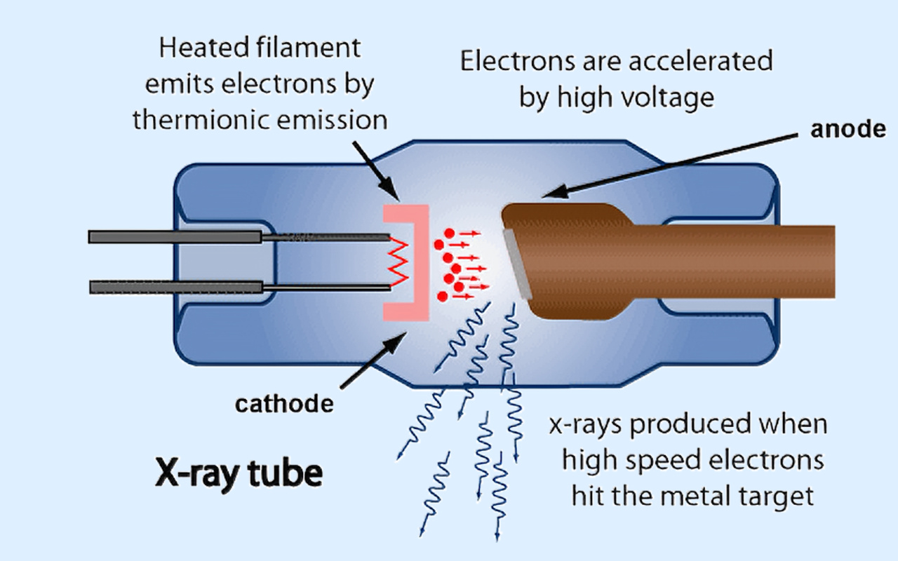 2. What X-ray Technology Actually Does 2. Kaj rentgenska tehnologija dejansko počne